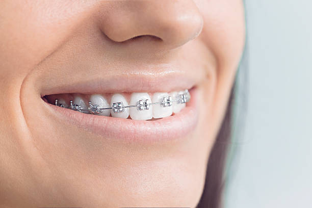 Why Choose Us for Your Dental Needs in North Miami, FL
